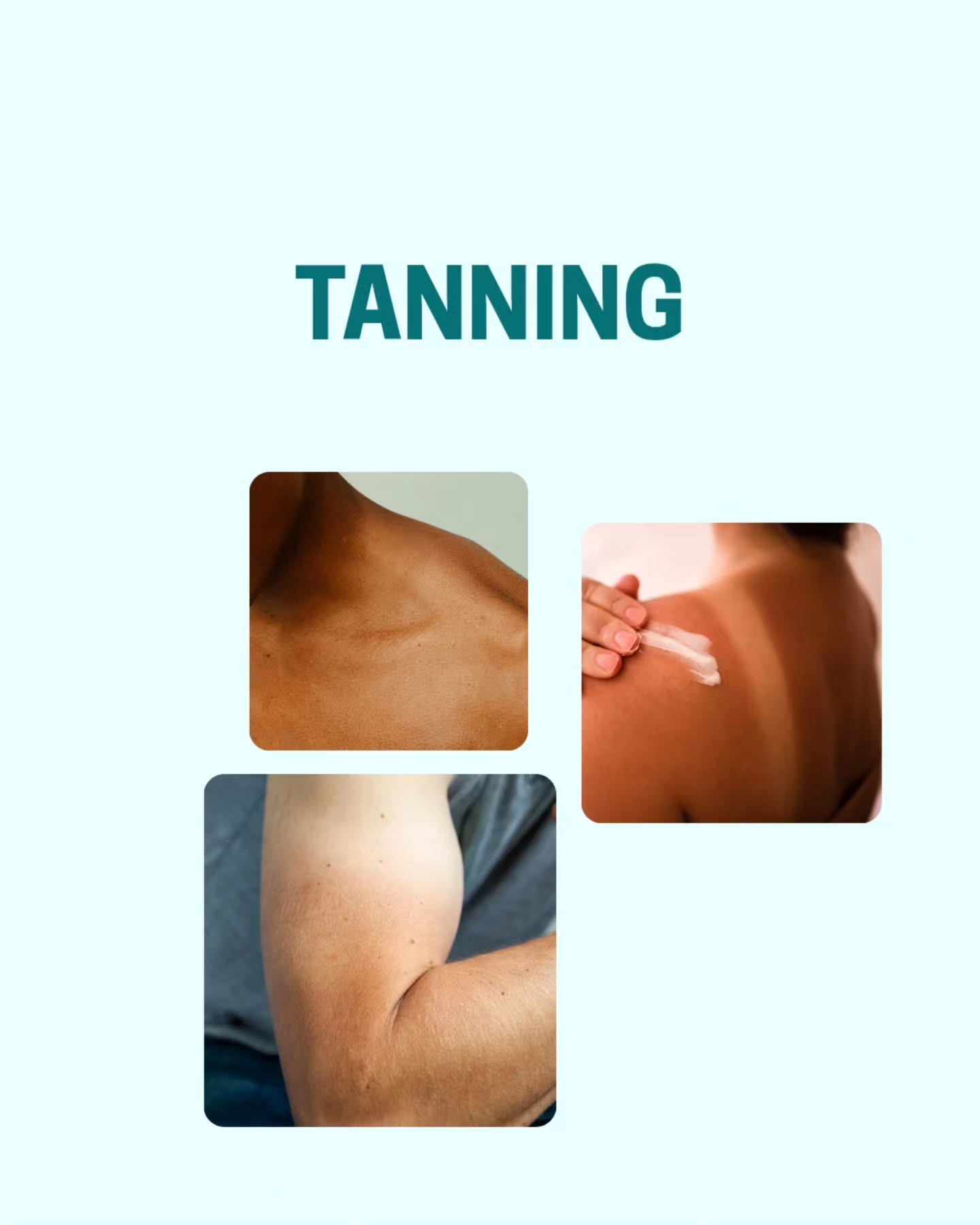Summer sun can silently damage your skin every single day.
This is your sign to never skip SPF again ☀️Buy any product & get a FREE sunblock because skincare without protection is incomplete.#summer #freebie #sunblock
